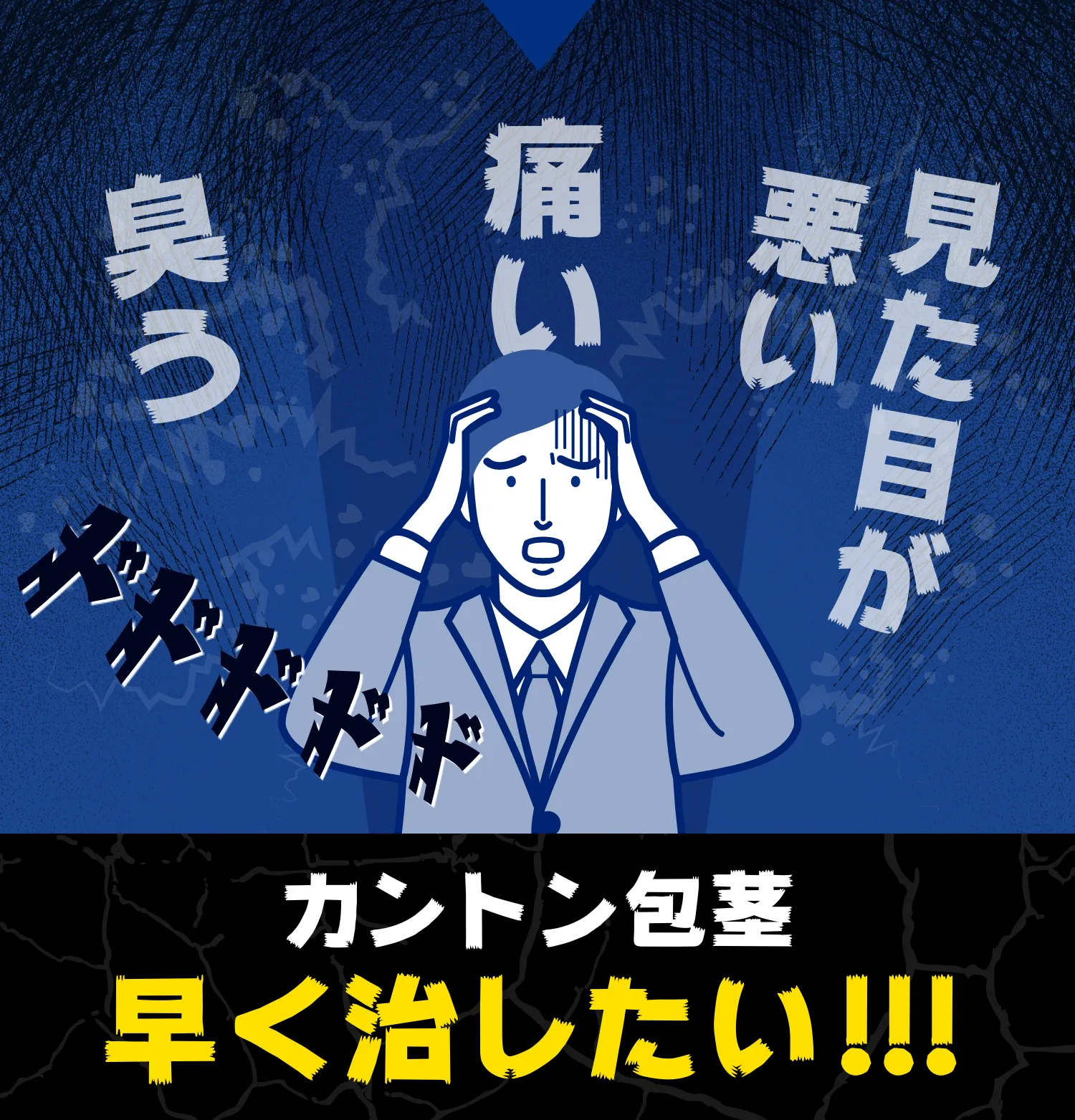 カントン包茎早く治したい